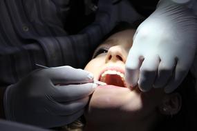 Zahnreinigung Dental Repairs