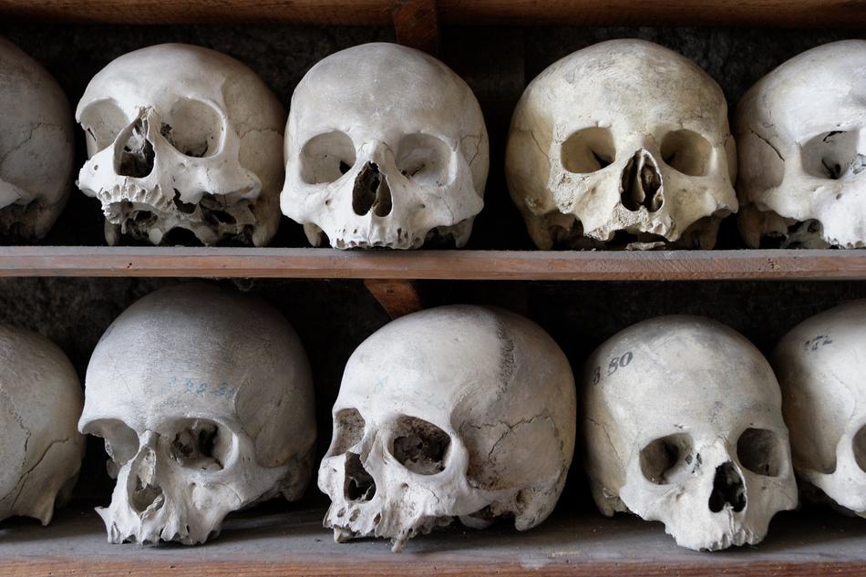 Skull Frame anatomy