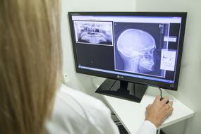 woman looking at skull X-ray on monitor