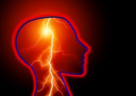 epilepsy seizure stroke headache drawing