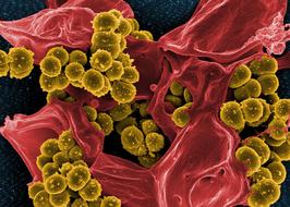 staphylococcus aureus Bacteria seen with Electron Microscope