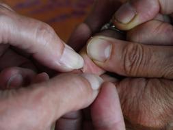 Wound, First Aid