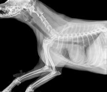 Radiography Bone
