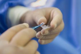 eye surgery