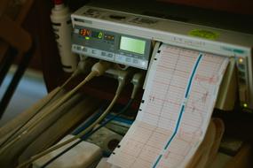 cardiogram print