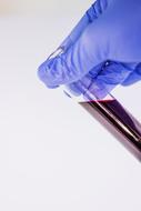 blood in test tubes in the hand of a laboratory assistant