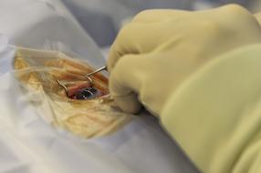 Surgeon Operation hand doctor