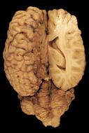 cross section of the brain