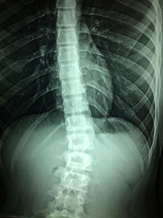 X-ray image