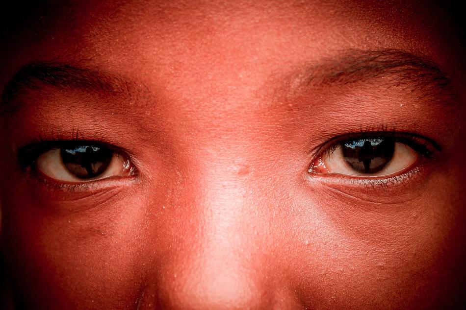red Child Face