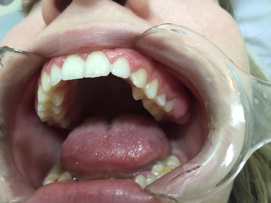 open mouth at the dentist's appointment