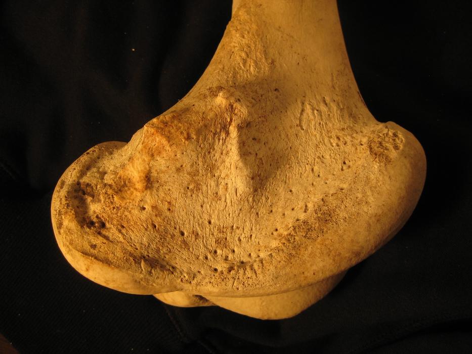 Bone Femur old