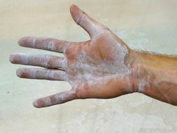 White magnesium, on the hand of a climber
