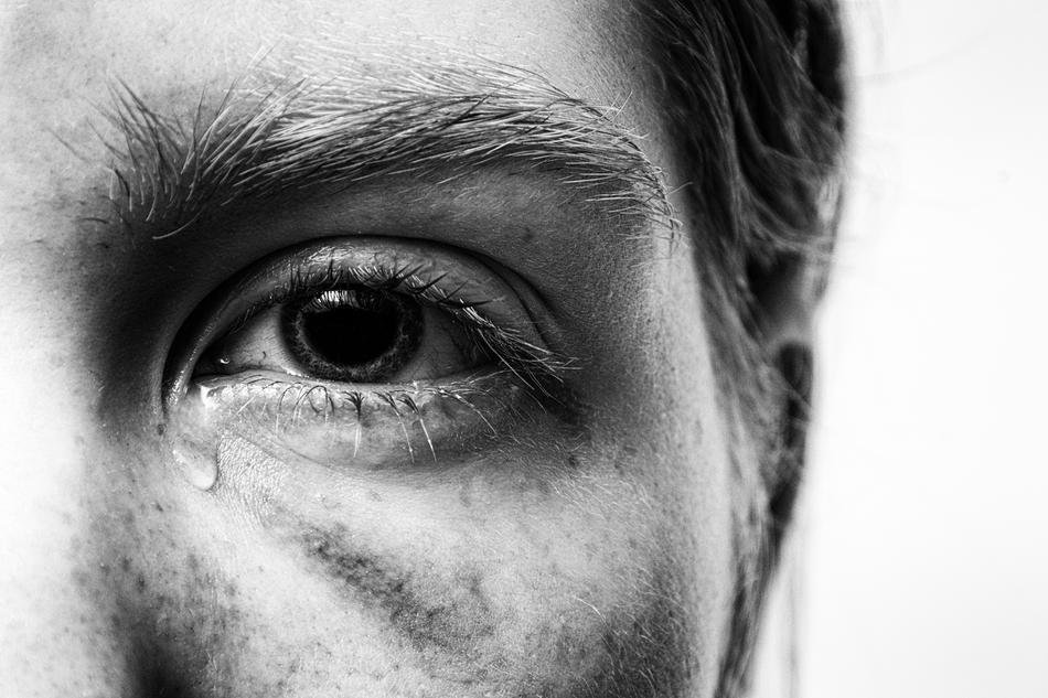 womanâs eye with tears
