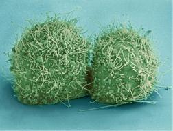 Hela Cells Bacteria