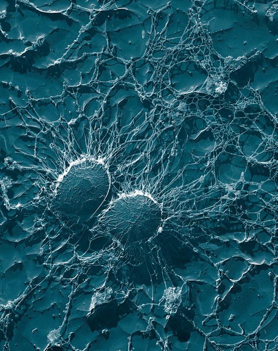 increase in staphylococcal bacteria