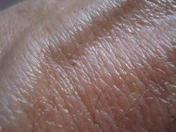 Skin Vein Brown macro