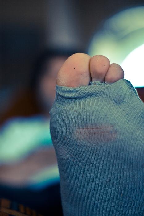closeup view of Holes Socks Toes