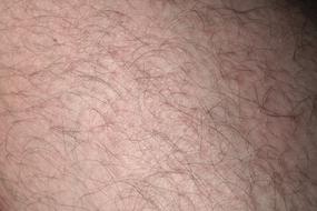 hair on the skin close-up