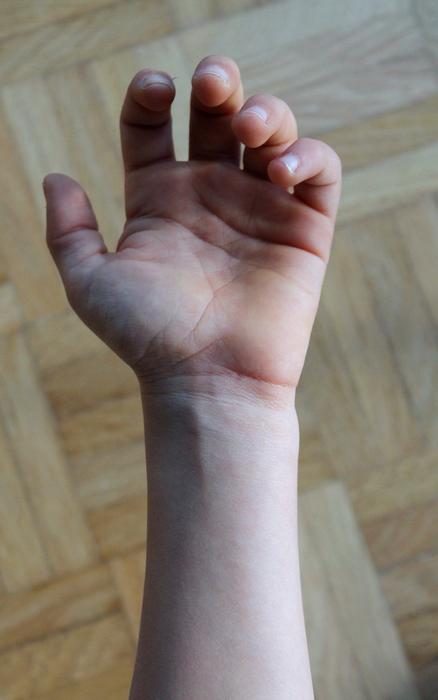 Hand Fingers Veins