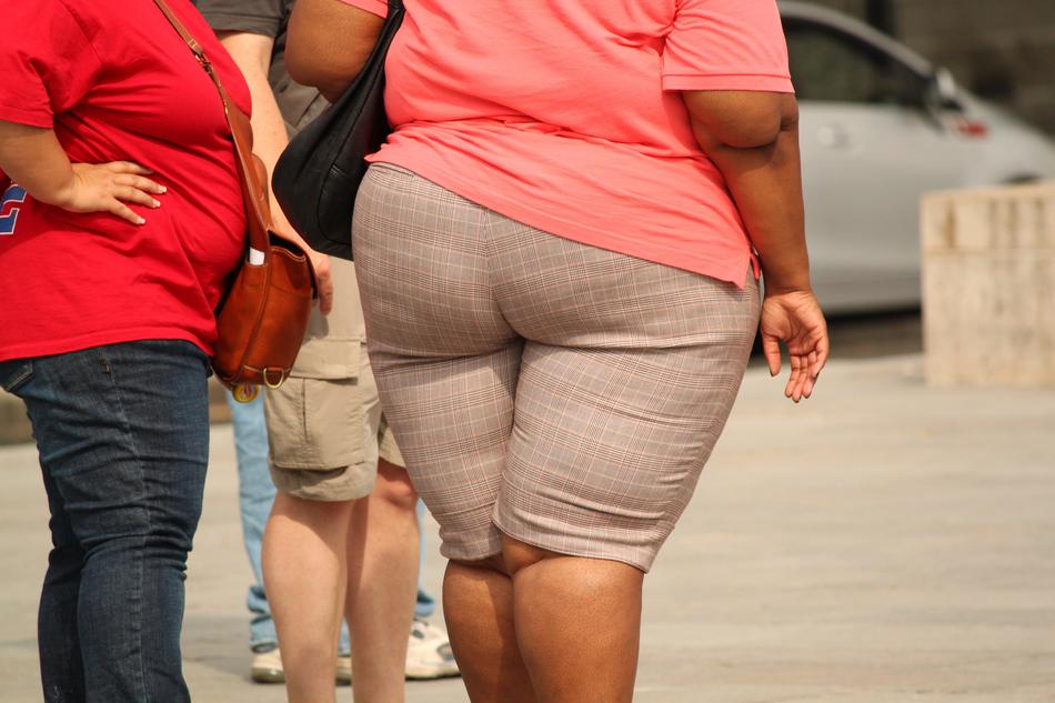 Thick Overweight Obesity