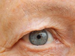 Eye View