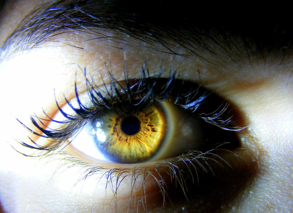 Eye Brown Yellow