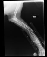 Broken Arm X-Ray Shin English