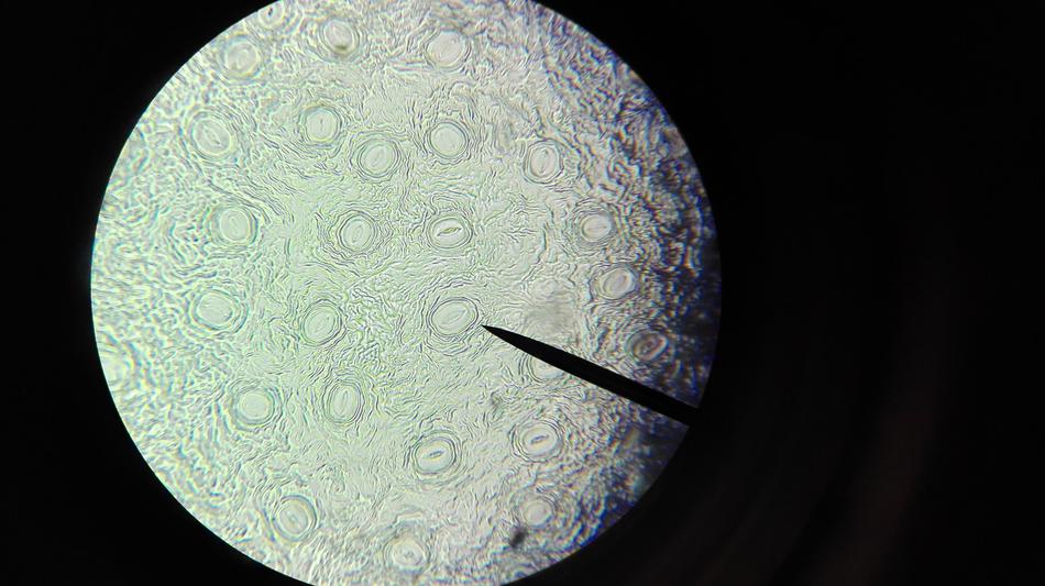 microscope view of a microbe