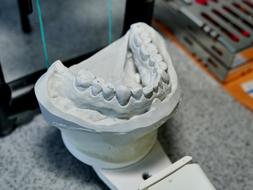 Dental sculpture of the mouth