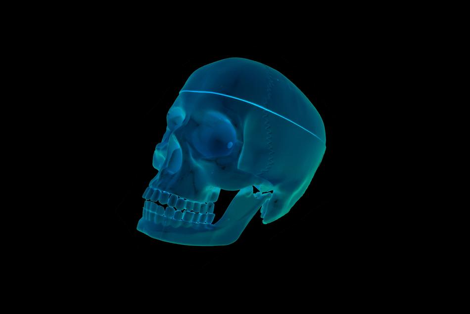 skull roentgen 3d