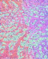 pink turquoise background