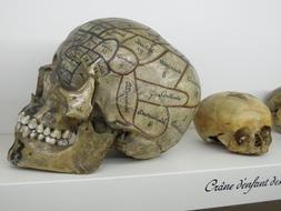 Skull in Phrenology Museum