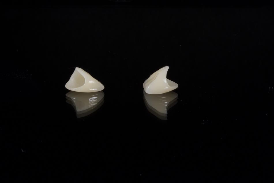 Dental Porcelain Tooth in dark