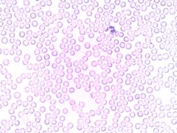 Drops of pink on a white background