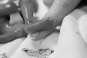 Stillborn Baby