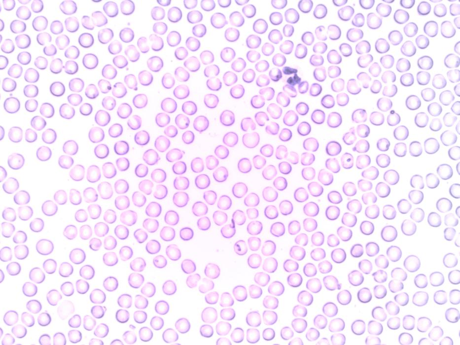 Drops of pink on a white background
