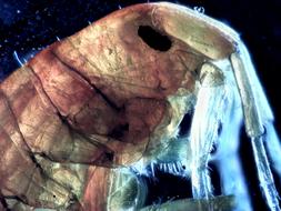 bug under a microscope