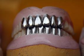 iron teeth on the jaw