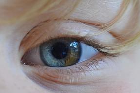 Eye Color Yellow