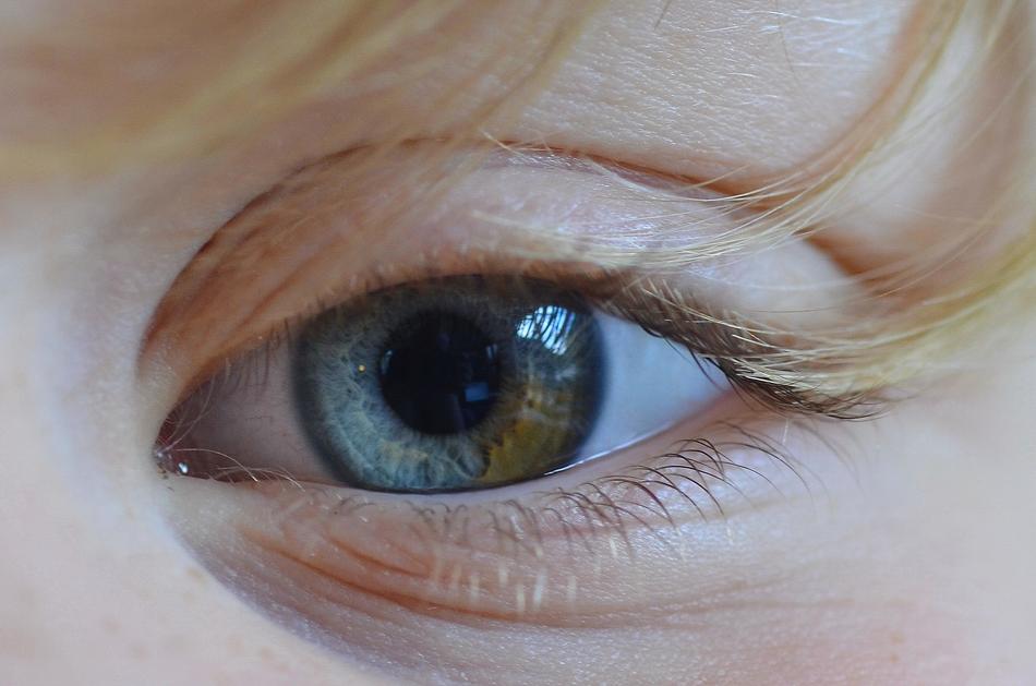 Eye Color Yellow