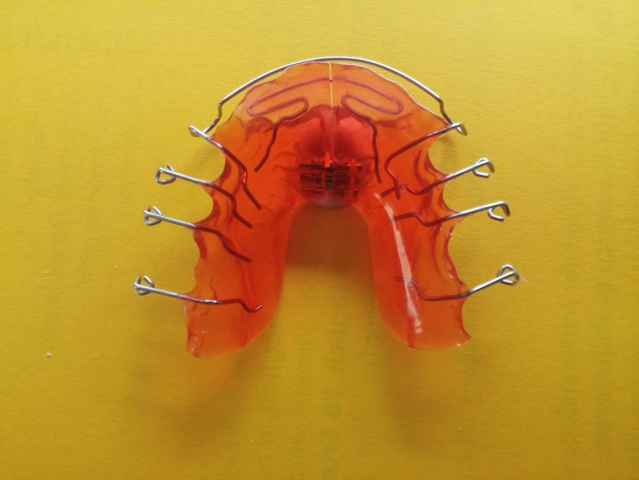 jaw prosthesis