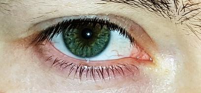 eye green red