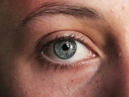 Eye and Skin