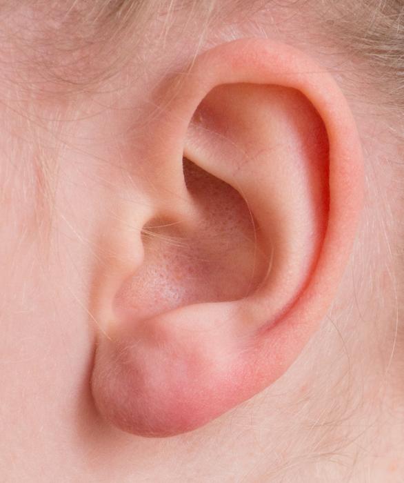 Ear head pink