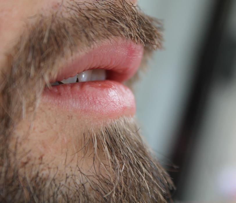 Close-up of the mouth of a man, with shiny teeth, bead and mustache