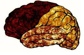 dying brain drawing