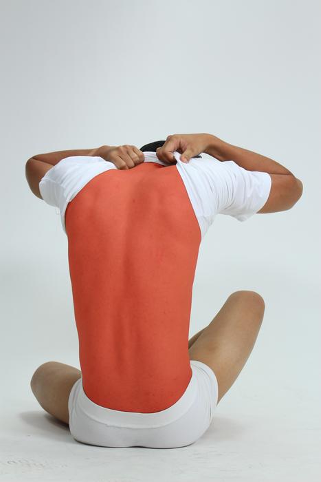 photo of burnt red back