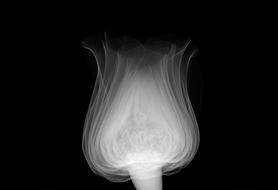 Rose as a Xray