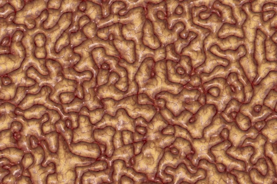 Brain Mass as background